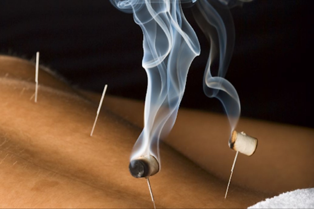 Moksibusi, adalah teknik dalam pengobatan melibatkan pembakaran ramuan tanaman mugwort  untuk memanaskan titik-titik akupunktur tertentu pada tubuh. 