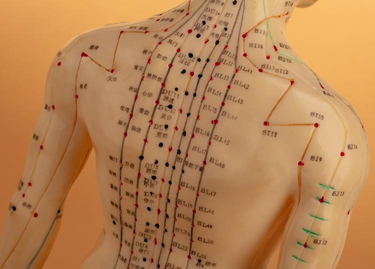 Pengobatan Diabetes Mellitus (DM) dengan akupunktur bertujuan untuk membantu mengatur kadar gula darah, meningkatkan fungsi organ dan memperbaiki metabolisme.