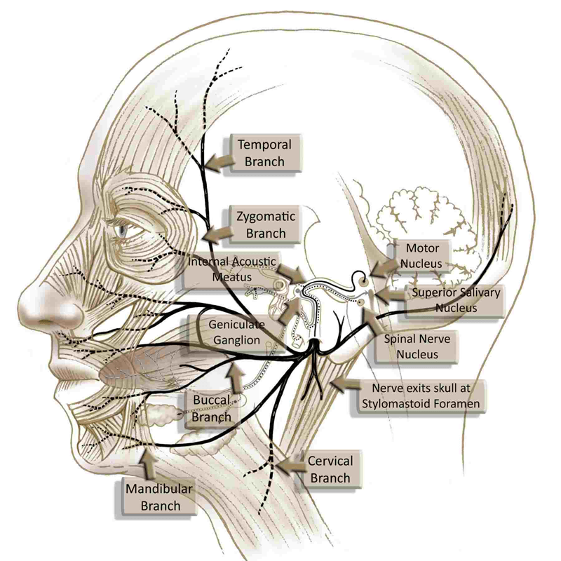 Bell's Palsy adalah kondisi yang menyebabkan kelumpuhan mendadak pada satu sisi wajah (unilateral) akibat gangguan saraf wajah (nervus facialis). Penanganan Bell's palsy  dengan akupunktur adalah salah satu metode yang sering digunakan untuk membantu memulihkan fungsi otot wajah.